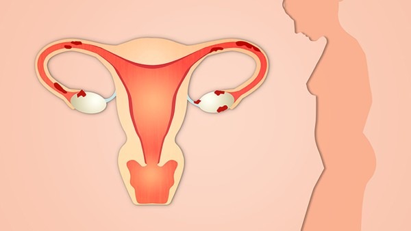 子宫内膜薄需要做宫腔镜检查吗